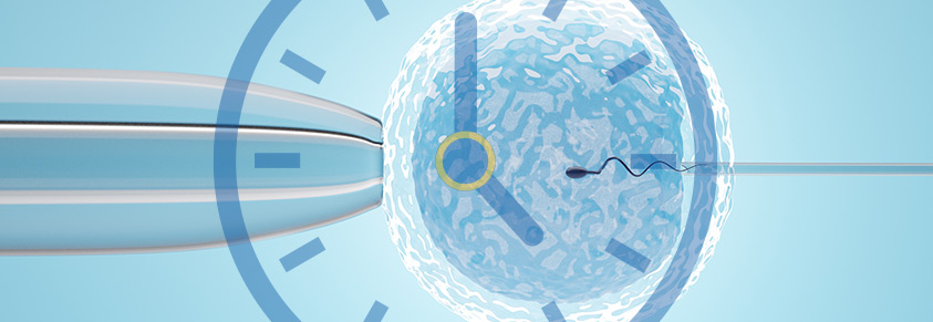 Das künstliche Einsetzen eines Spermiums in eine Eizelle, davor eine stilisierte Uhr