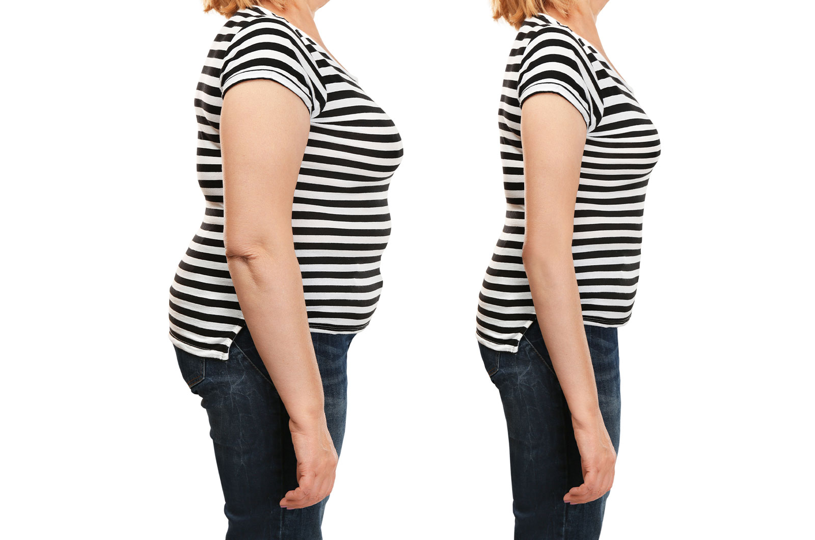 Frau vor und nach der Gewichtsabnahme 
