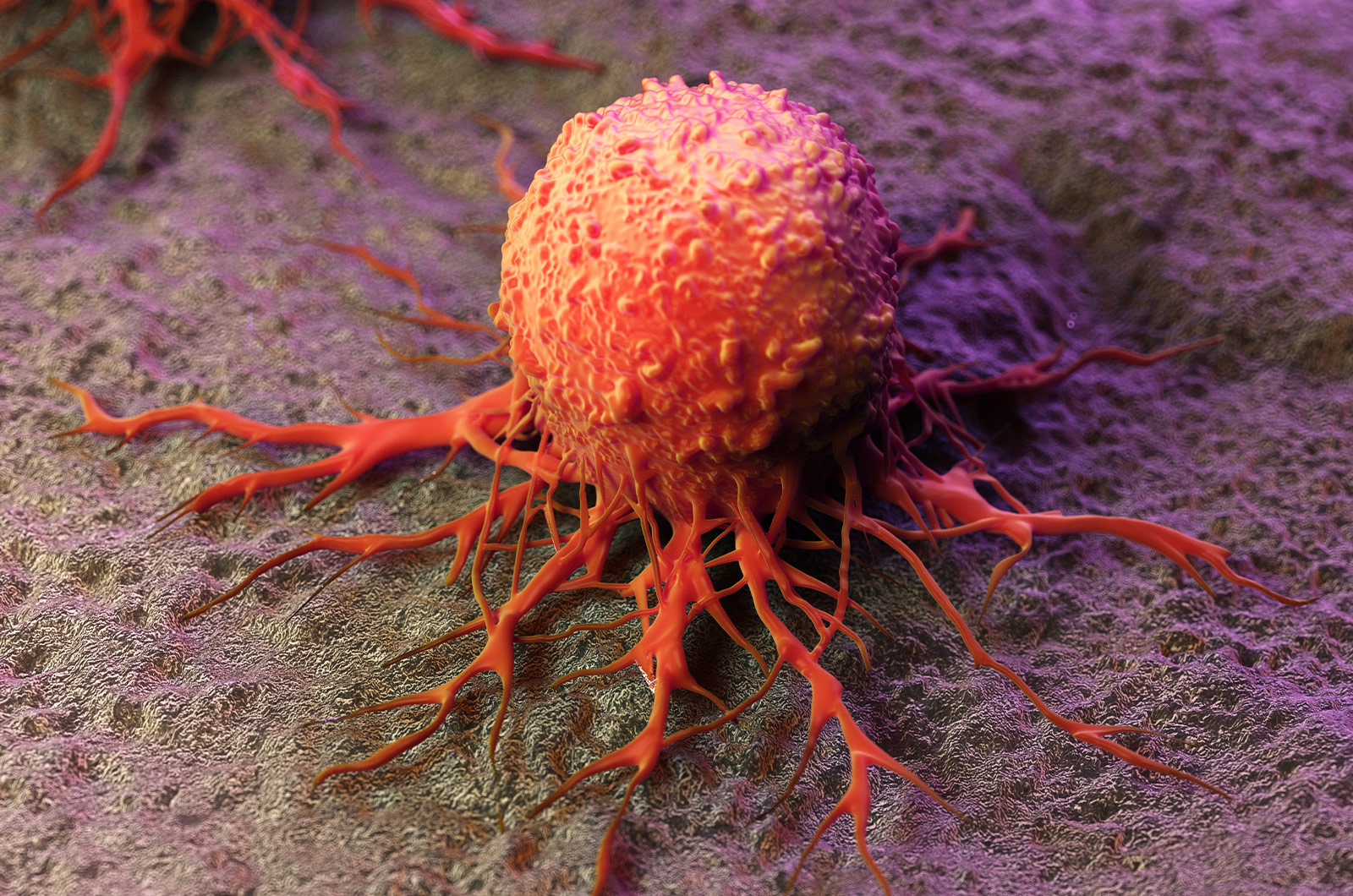 medizinisch genaue Darstellung einer Krebszelle