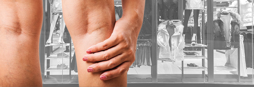 Im Hintergrund ein Schaufenster eines Bekleidungsgeschäftes, davor zwei weibliche Beine, das rechte wird vor Schmerz gehalten