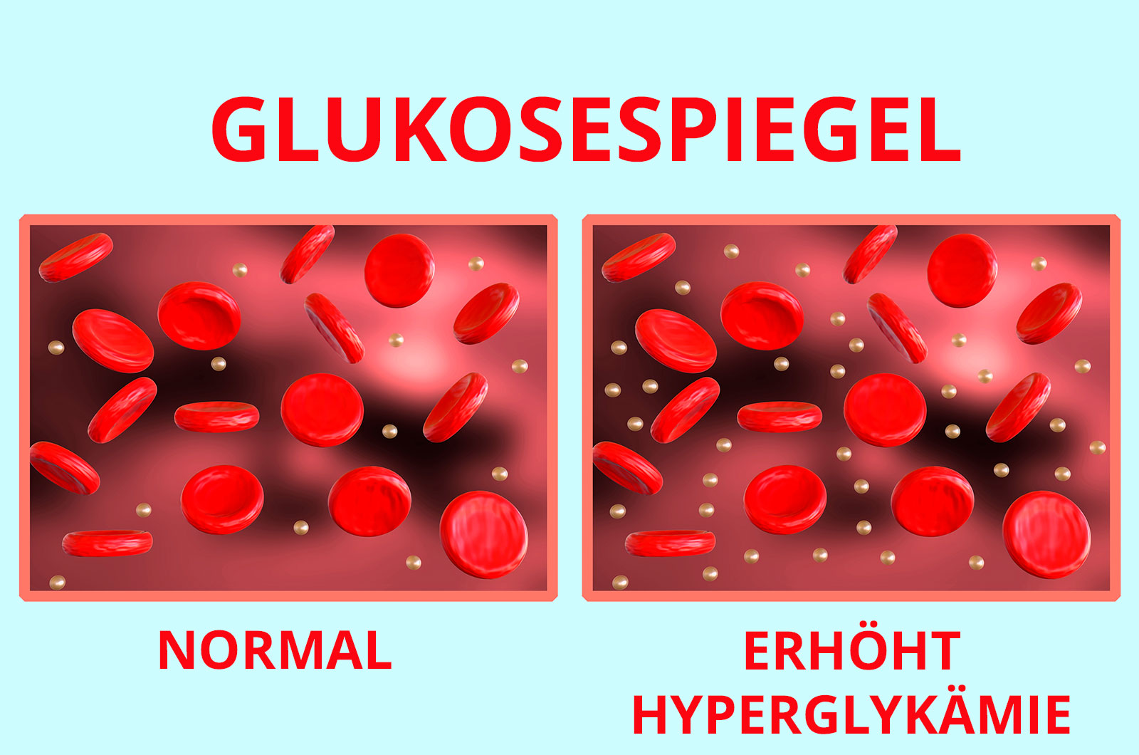 Glukosespiegel im Blut, Abbildung mit normalen Werten, Abbildung mit erhöhten Werten, die auf Diabetes hinweist
