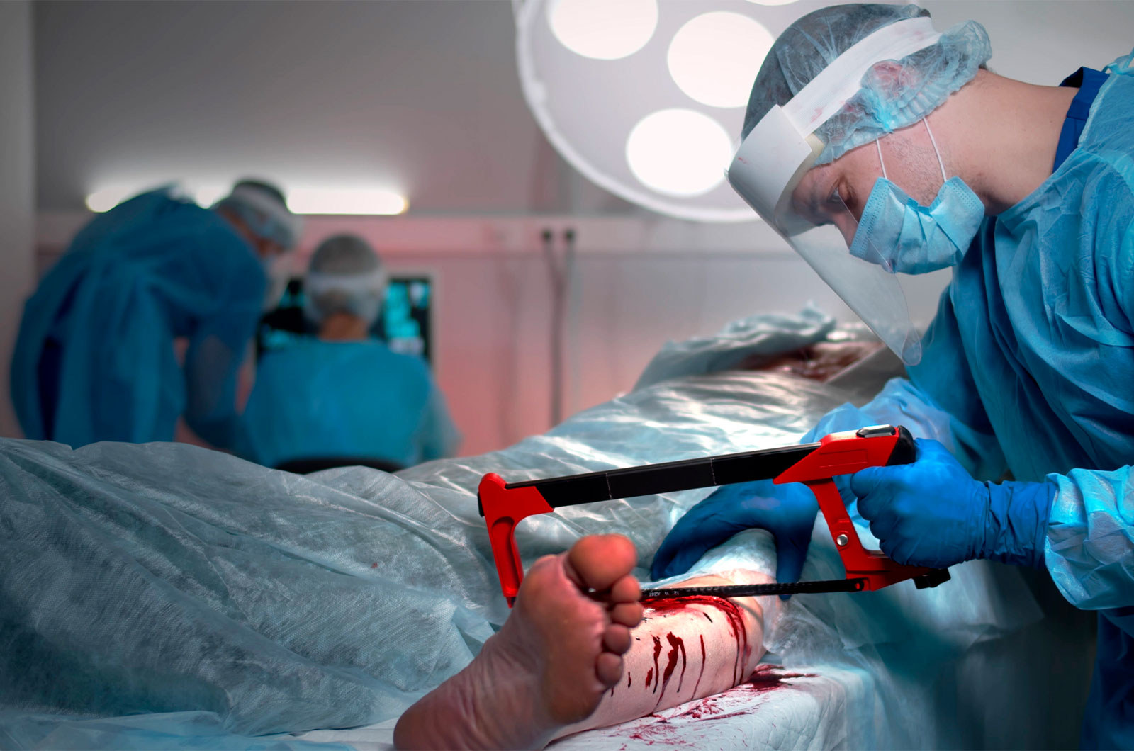 Chirurg mit Amputationssäge amputiert bei einem Patienten das linke Bein im Operationssaal