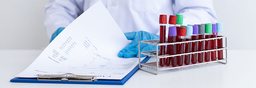 Ärzte analysieren und untersuchen die Blutproben in Reagenzgläsern 