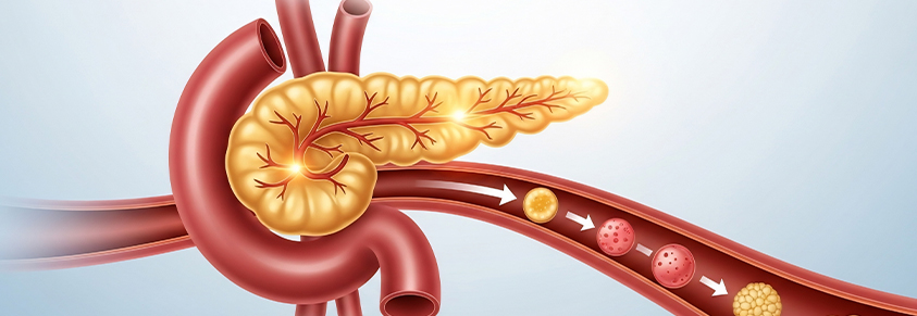 Darstellung der Bauchspeicheldrüse, Insulinproduktion und -freisetzung in den Blutkreislauf