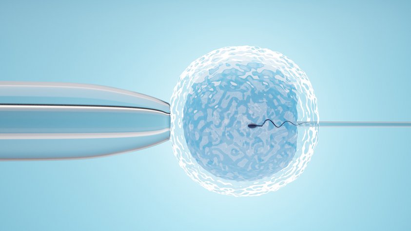 Das künstliche Einsetzen eines Spermiums in eine Eizelle